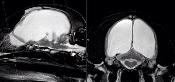 Brain scan of dog showing hydrocephalus