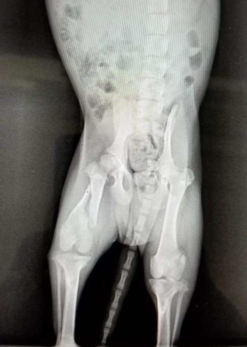 X-ray of a broken leg