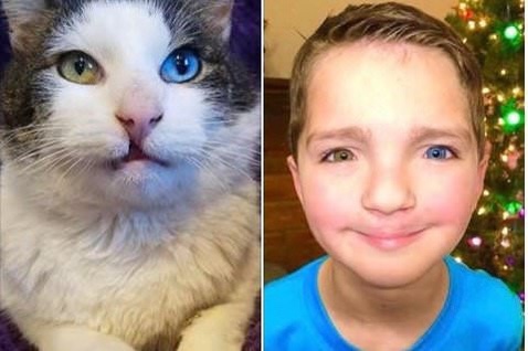 Cat and little boy with eye disease 